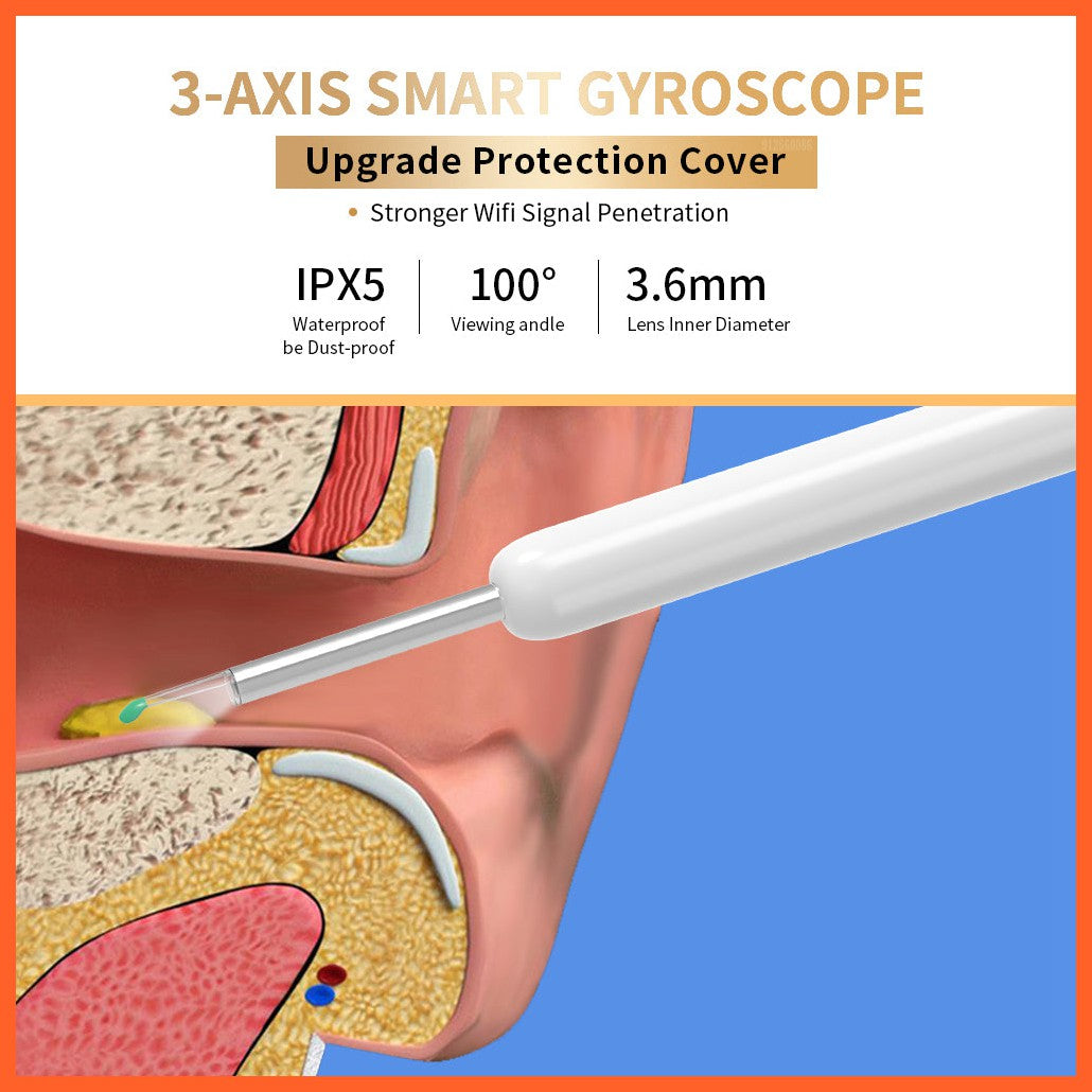 Ne3 Ear Cleaner Otoscope Ear Wax Removal Tool With Camera Led Light Wireless Ear Endoscope Ear Cleaning Kit For I-Phone