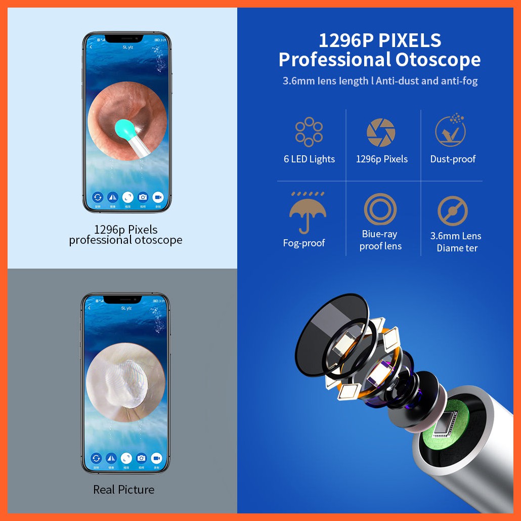 Ne3 Ear Cleaner Otoscope Ear Wax Removal Tool With Camera Led Light Wireless Ear Endoscope Ear Cleaning Kit For I-Phone